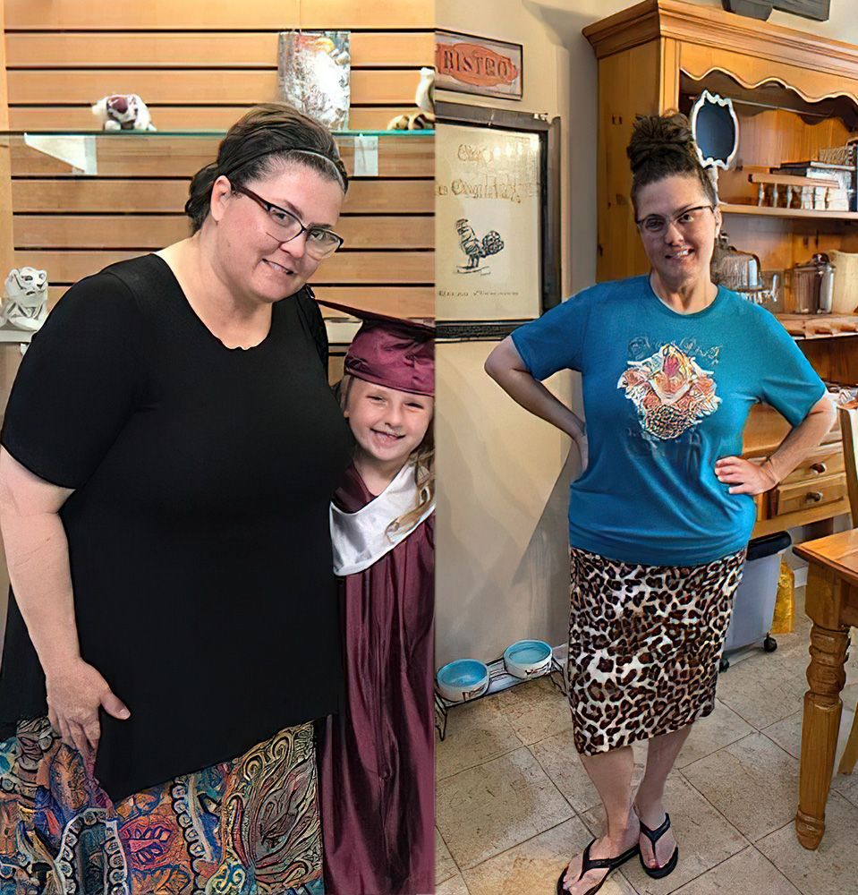 before and after