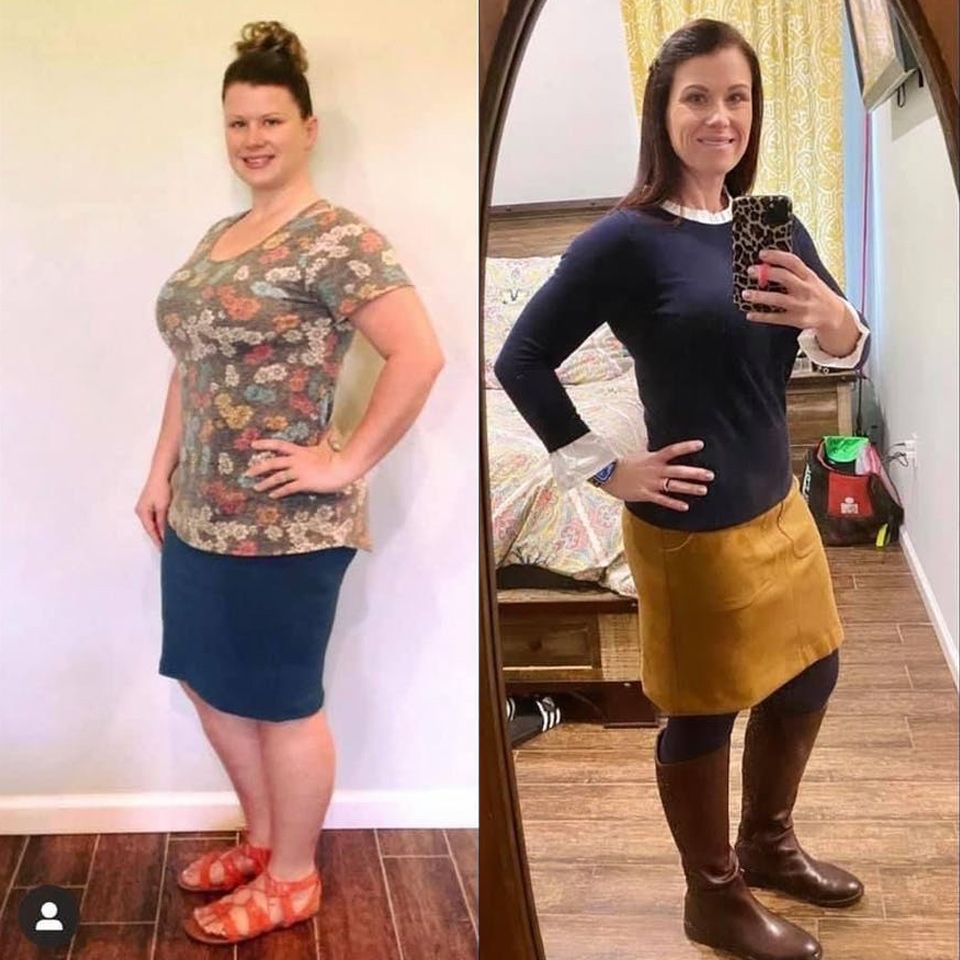 Patient before and after 3