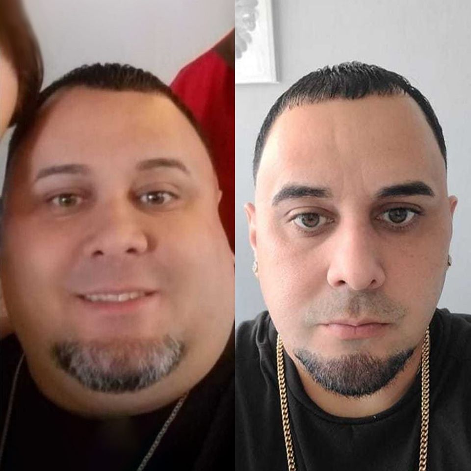 Patient before and after 4